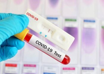 С 1 декабря отрицательный результат теста ПЦР должен представляться раз в 7 дней: Анаит Аванесян