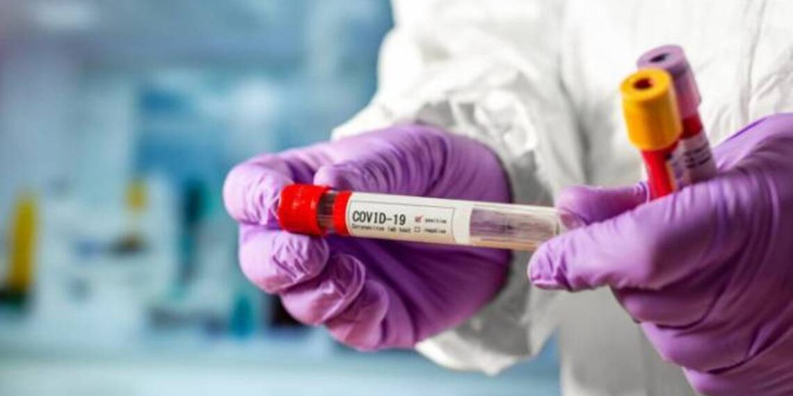 В Арцахе подтверждено 220 новых случаев заболевания COVID-19