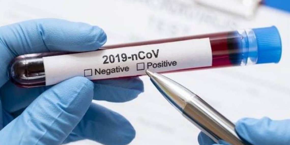 В Арцахе подтверждено 8 новых случаев заболевания COVID-19