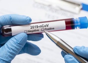В Арцахе подтверждено 8 новых случаев заболевания COVID-19