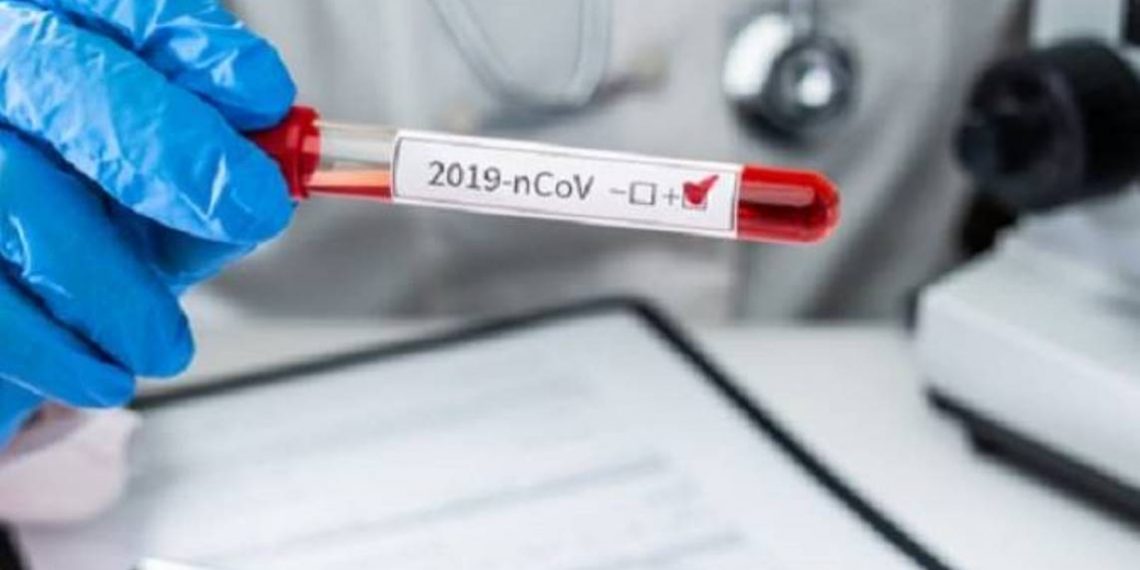 COVID-19: в Арцахе подтверждено 5 новых случаев