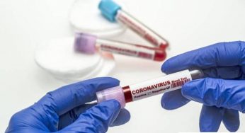 В Арцахе за прошедший день подтвержден 1 новый случай заболевания COVID-19