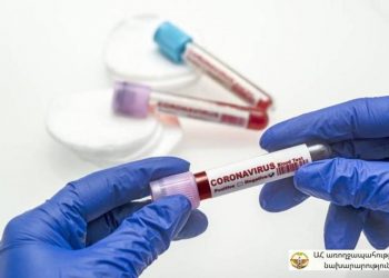 В Арцахе за прошедший день подтвержден 1 новый случай заболевания COVID-19