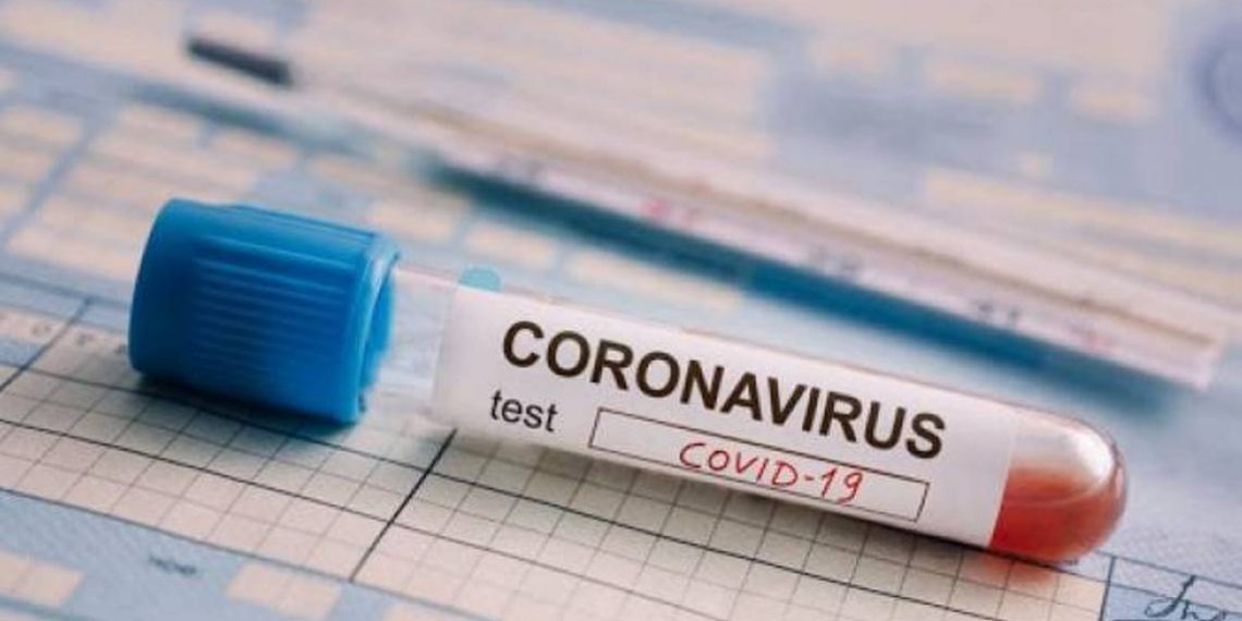 COVID-19: в Армении за сутки подтвержден 21 случай