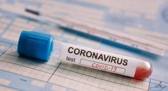 COVID-19: в Армении за сутки подтвержден 21 случай