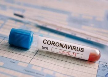 COVID-19: в Армении за сутки подтвержден 21 случай