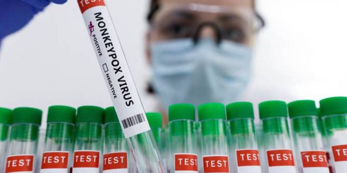 Что нужно знать об обезьяньей оспе? «Арменпресс» представляет ответы на наиболее часто задаваемые вопросы