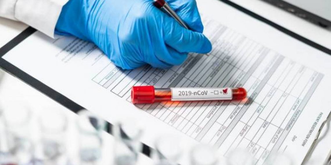 Рост заболеваемости COVID-19 связан с активизацией поездок: Анаит Аванесян