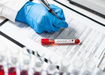 Рост заболеваемости COVID-19 связан с активизацией поездок: Анаит Аванесян