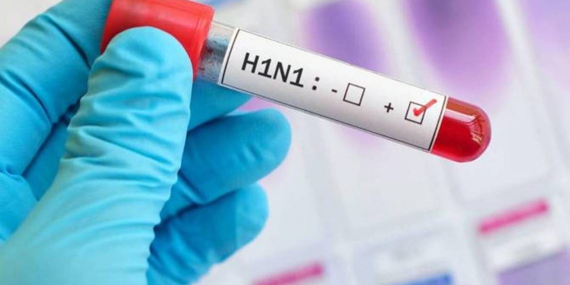 В Армении подтвержден возбудитель вируса гриппа типа А (H1N1)