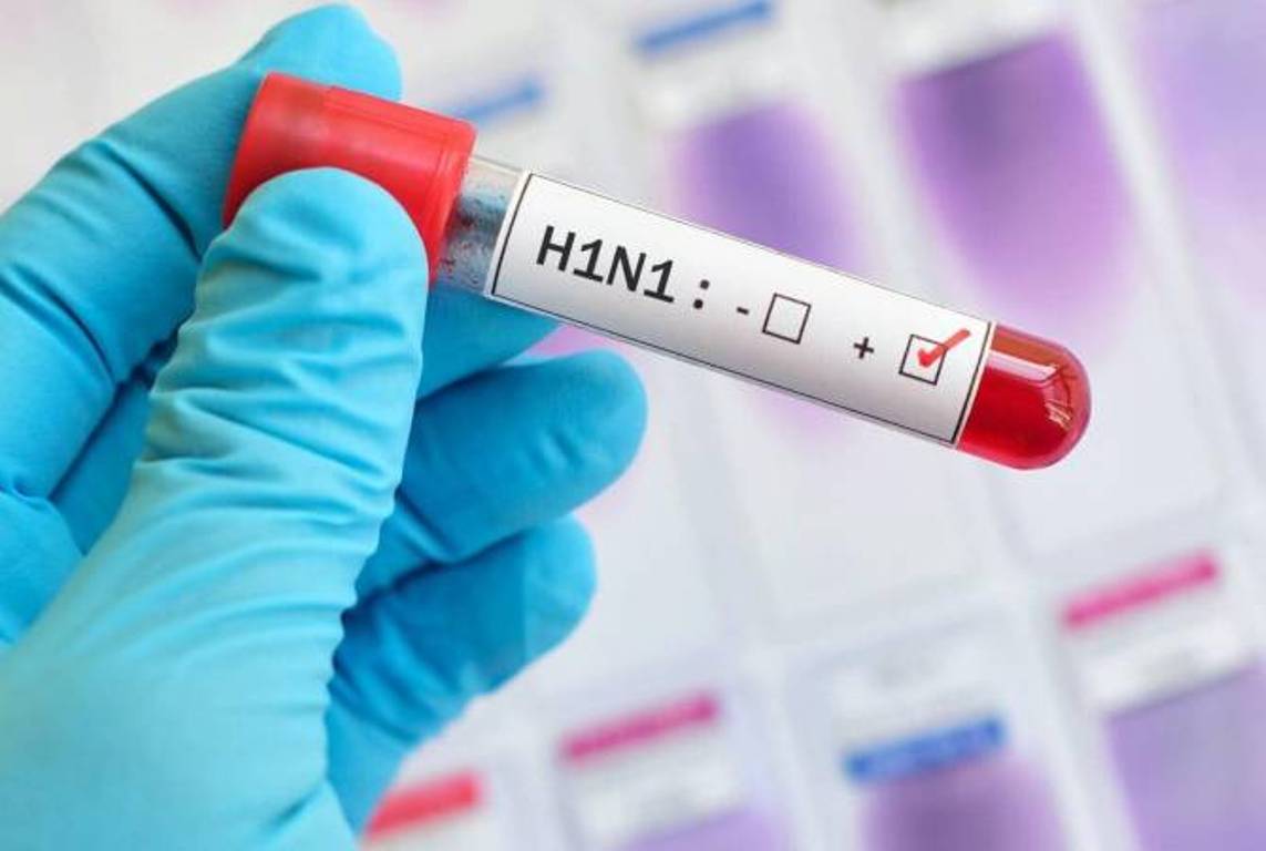 В Армении подтвержден возбудитель вируса гриппа типа А (H1N1)