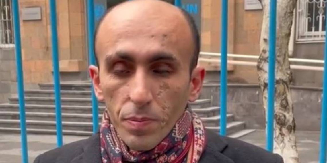 Артак Бегларян объявил о бессрочной сидячей забастовке и начале движения в Ереване