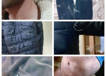 Азербайджанцы в штатском напали на молодых людей в районе общины Гетаван